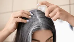 Så döljer du grått hår när färgen inte fäster: 6 beprövade naturliga huskurer