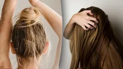 De här frisyrerna påskyndar håravfall – vanliga stylingmisstag du måste undvika